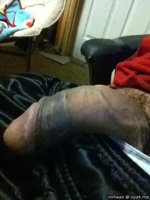 Photo of a short leg from Mrhead