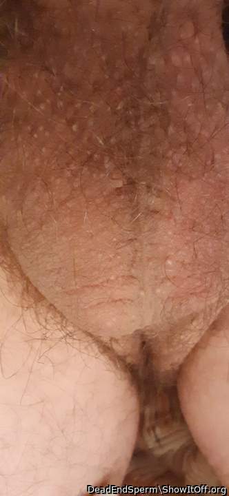 My balls(close up)