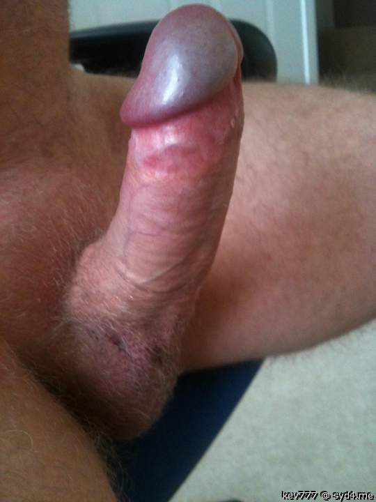 Awesome cock and glans!      
