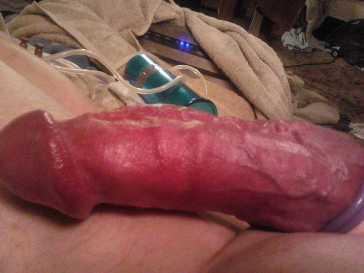 Photo of a penile from fish4free