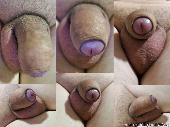 relaxed and contracted state of the penis, testicles and foreskin as usual