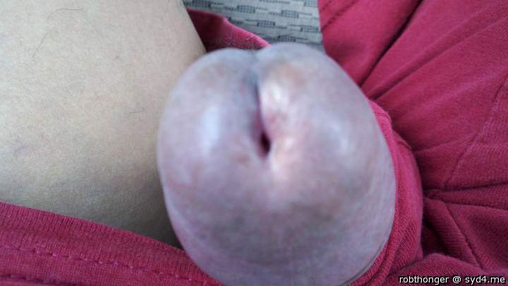 Photo of a penile from robthonger