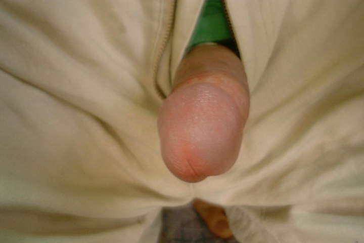Photo of a penis from ken
