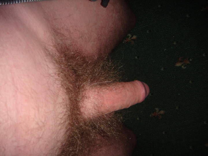 Photo of a penile from WILLTRIGGER
