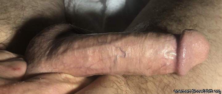 Photo of a penile from oneman