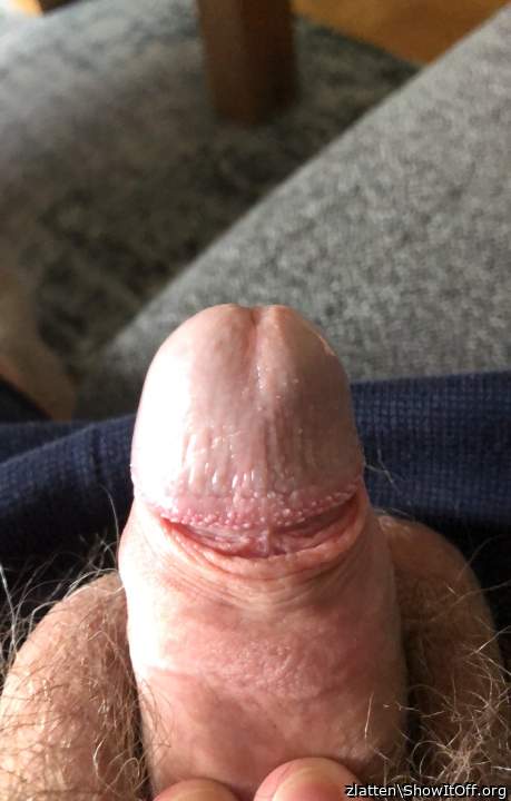 Photo of a penile from zlatten