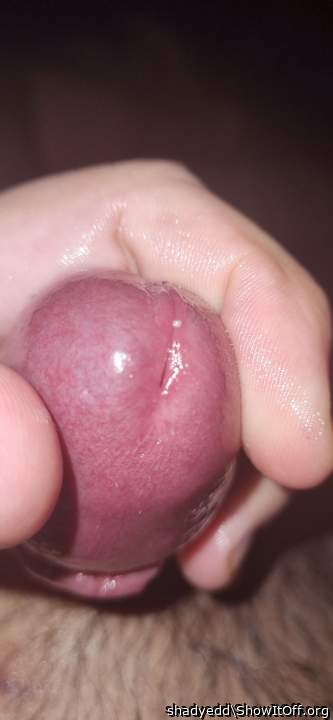Photo of a penile from shadyedd