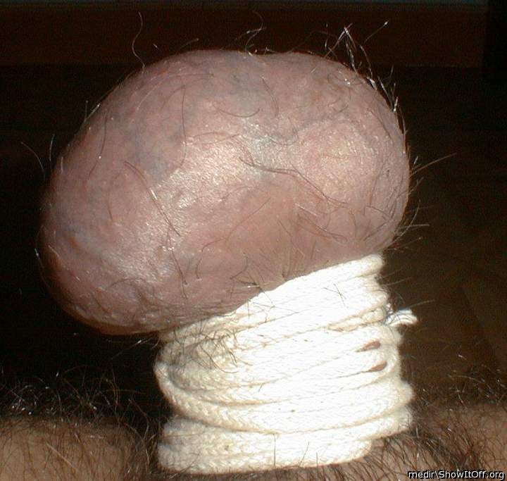 Testicles Photo from medir