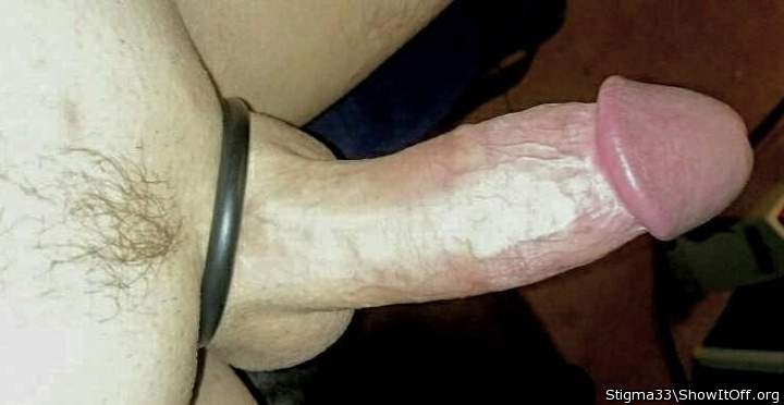 Photo of a penis from Stigma33
