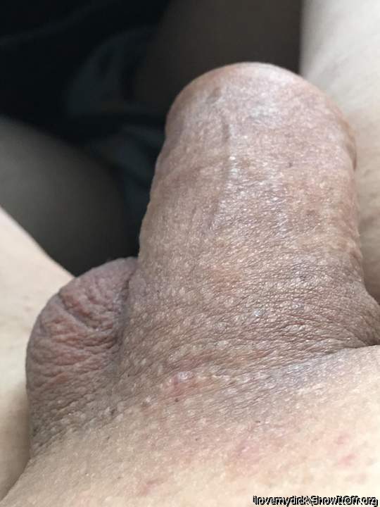 Photo of a penis from ilovemydick