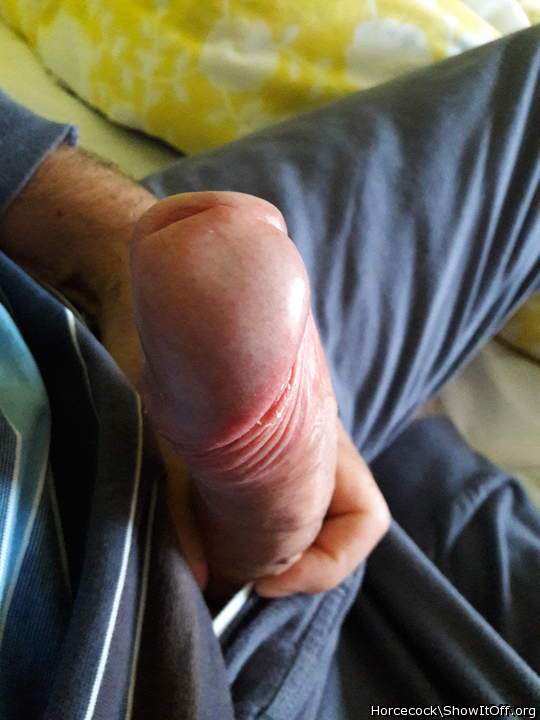 Photo of a penile from massivecock