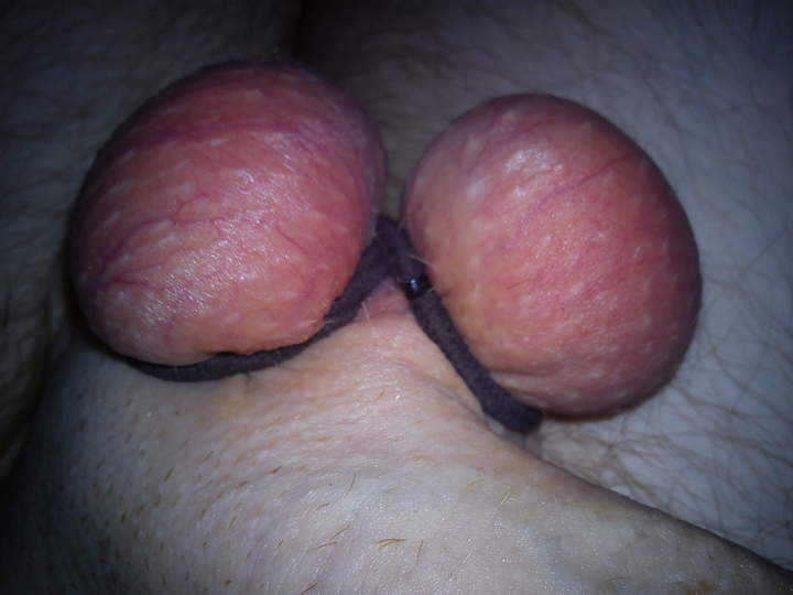 Testicles Photo from mack101