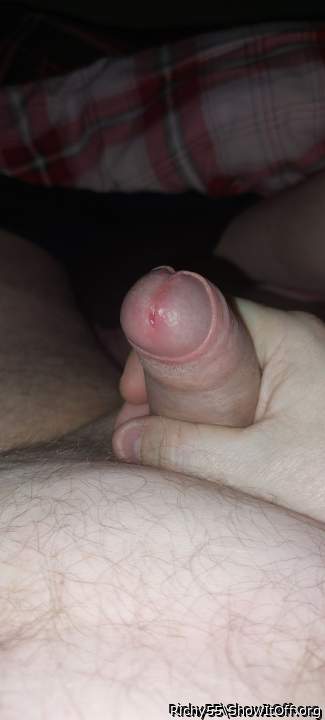 Photo of a penile from Richy55