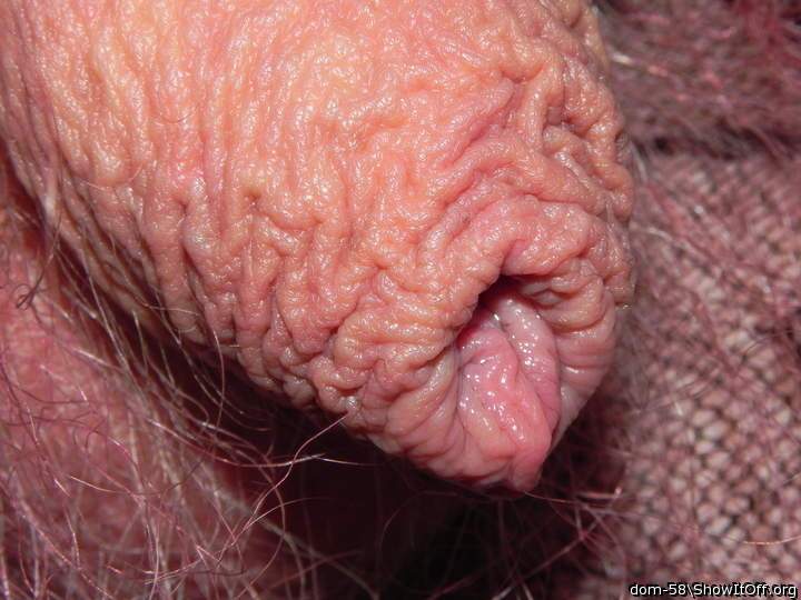 Photo of a penile from dom-58