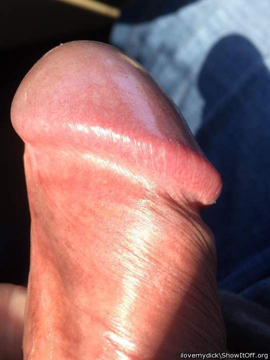 Photo of a penile from ilovemydick