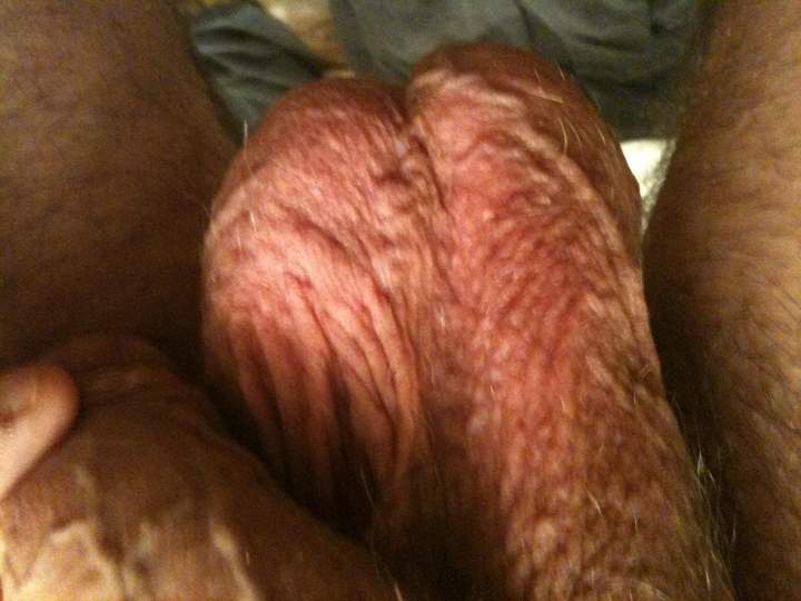 Testicles Photo from bdguy