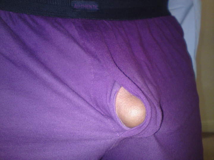 Photo of a penile from Sexbomb