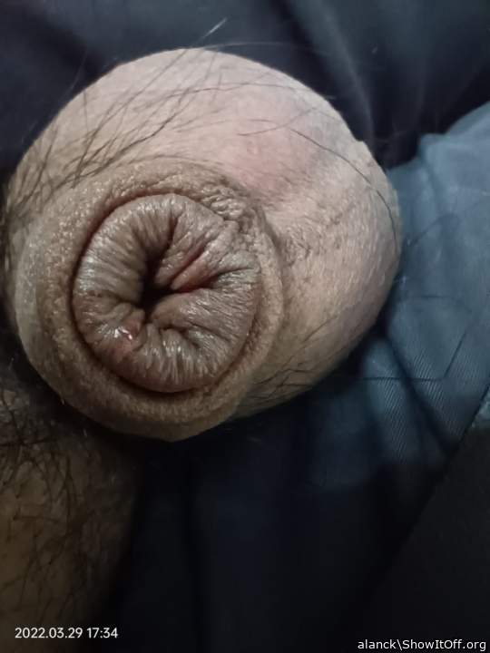 Photo of a penile from alanck