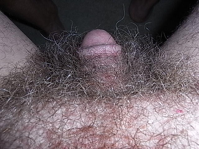 Disappearing into the pubic hair