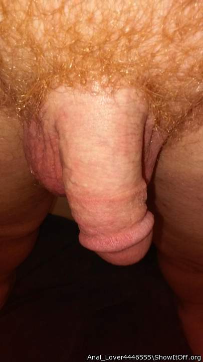 Photo of a private part from Anal_Lover4446555