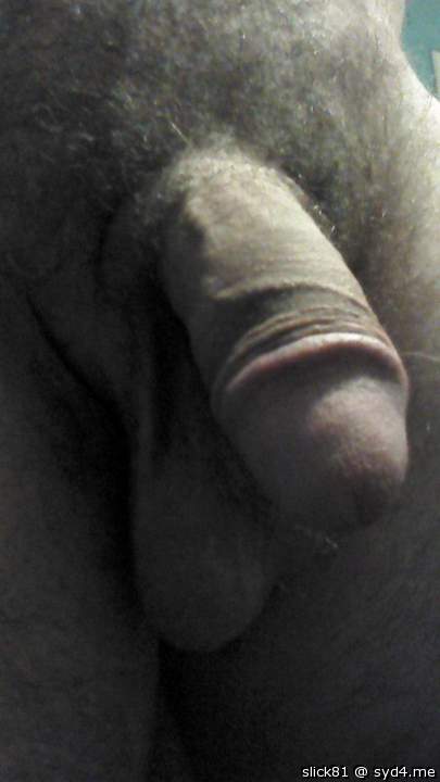 Photo of a penile from slick81