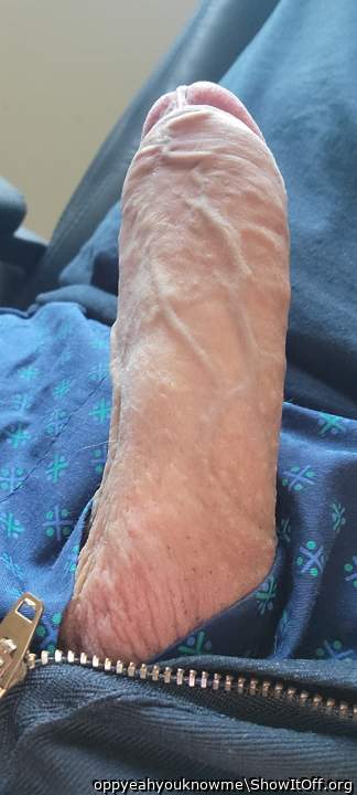 Photo of a middle leg from oppyeahyouknowme