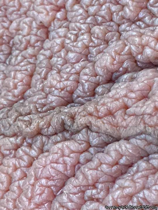 The texture of my balls