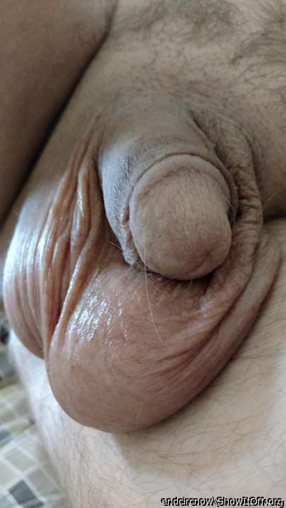 Photo of a penis from endcircnow