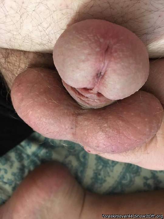 Photo of a phallus from foreskinlover44