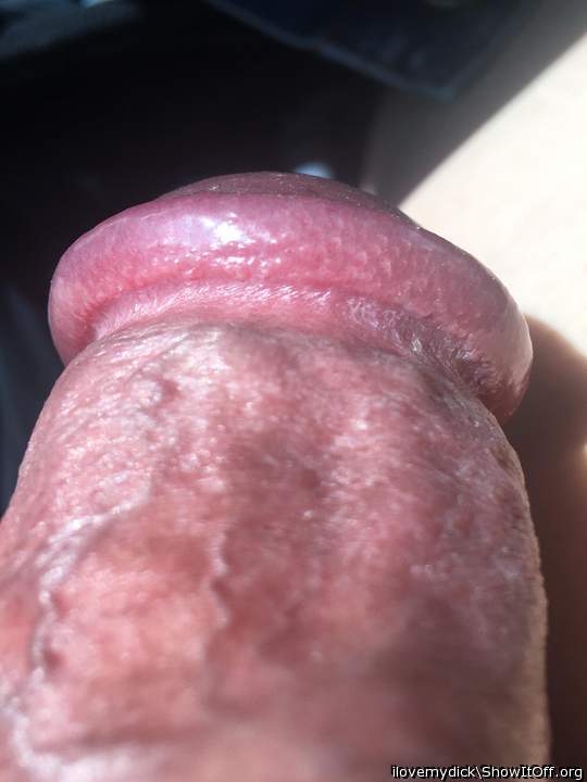 Photo of a middle leg from ilovemydick