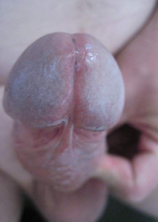 Photo of a penile from conan