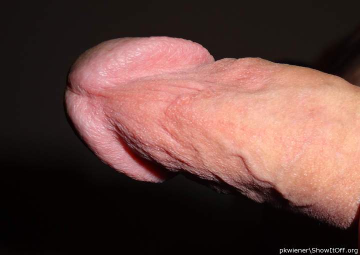 Photo of a penis from pkwiener