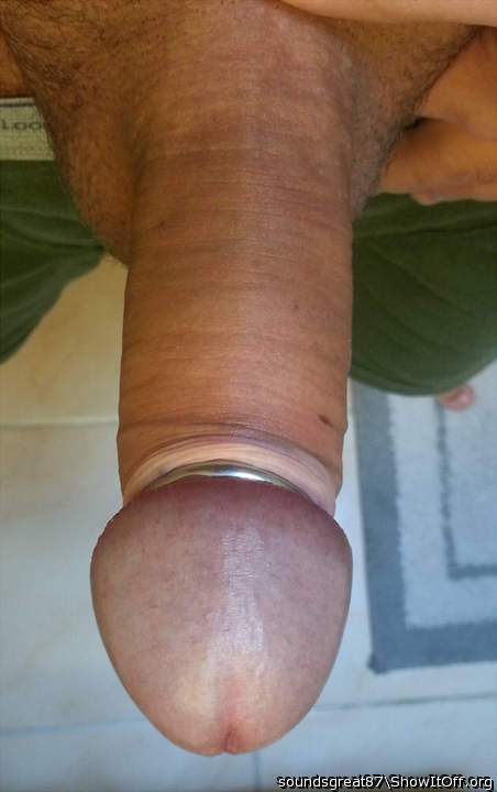 Steel glans ring holds my foreskin back