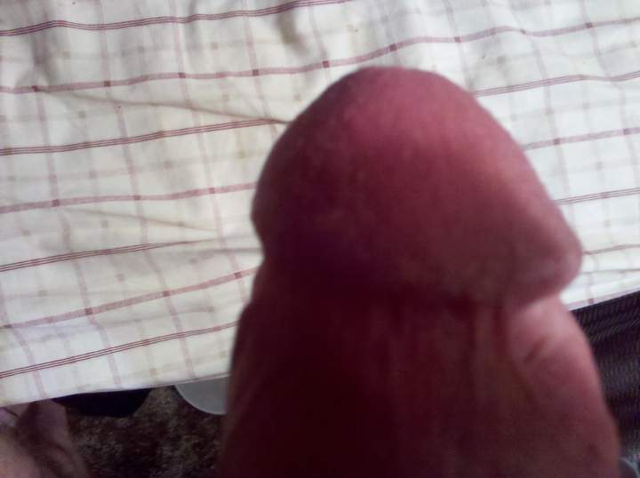Photo of a penile from skinb