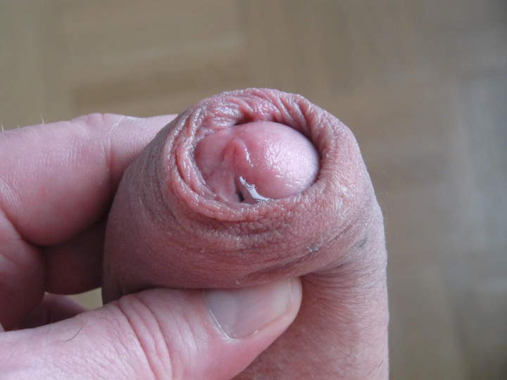 Photo of a penile from smallfined