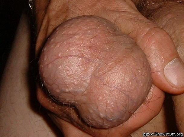Testicles Photo from pjtxx