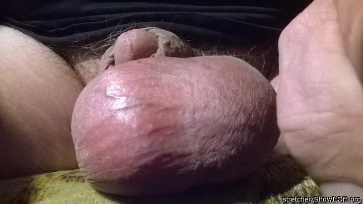 Testicles Photo from stretcher