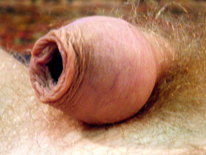 Photo of a penis from slipper