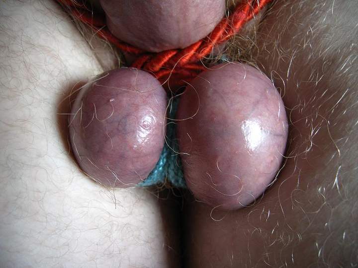 Testicles Photo from greenbelt
