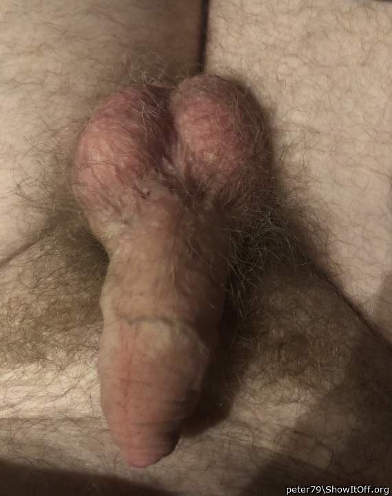 Photo of a penile from peter79