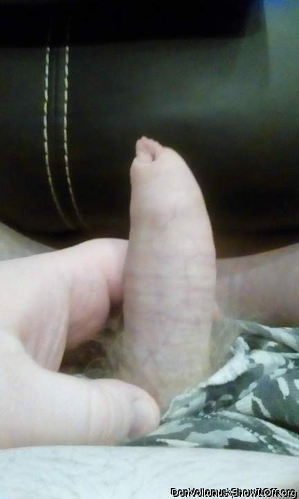 Fixed my foreskin! (Relaxed)