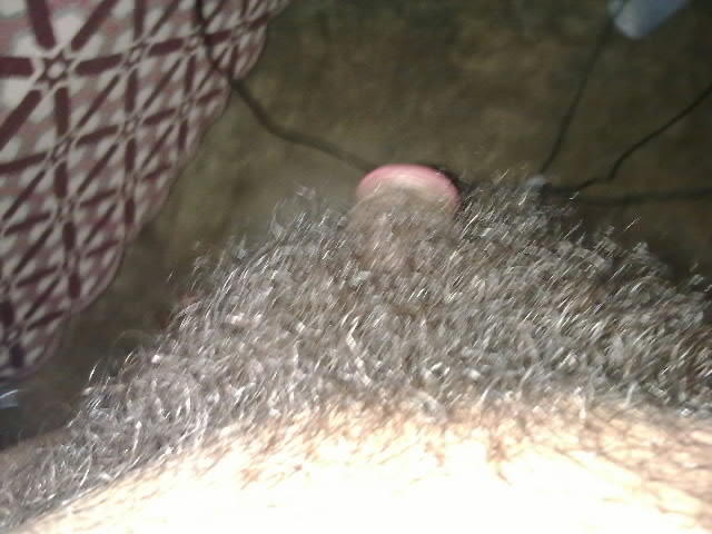 Photo of a penile from luckyboy87
