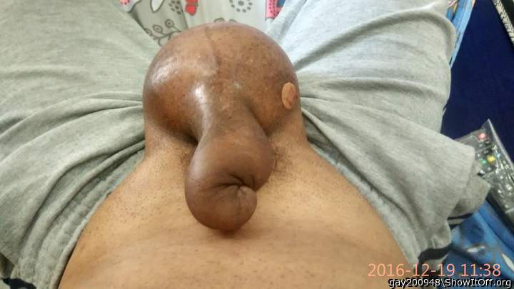 saline infusion in cock