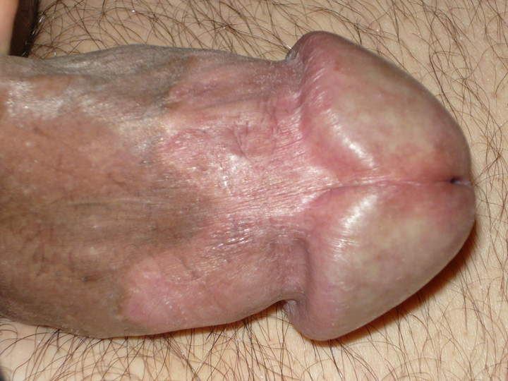 Photo of a penile from iambisex