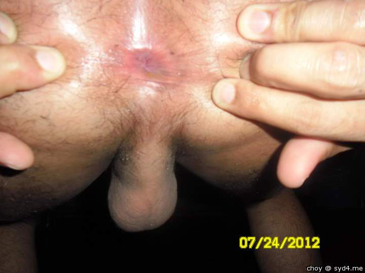 Photo of a penile from choy
