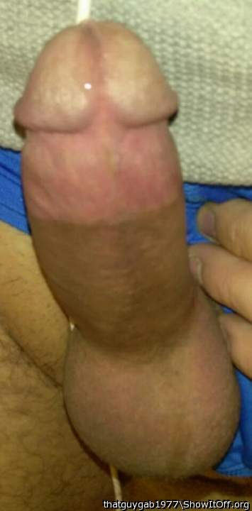 Photo of a penile from thatguygab1977