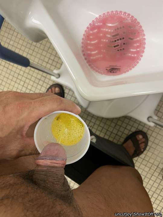 My Urine Sample
