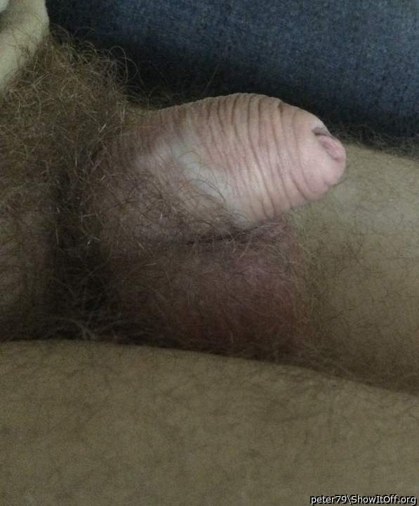 Photo of a short leg from peter79