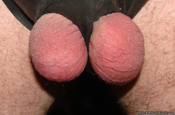 Testicles Photo from dischwa