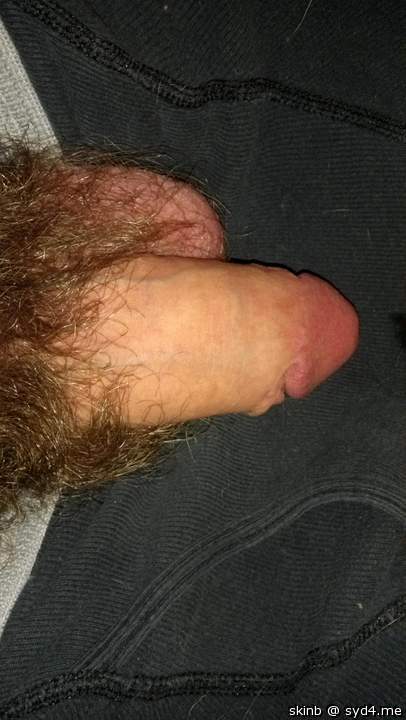 Photo of a penis from skinb